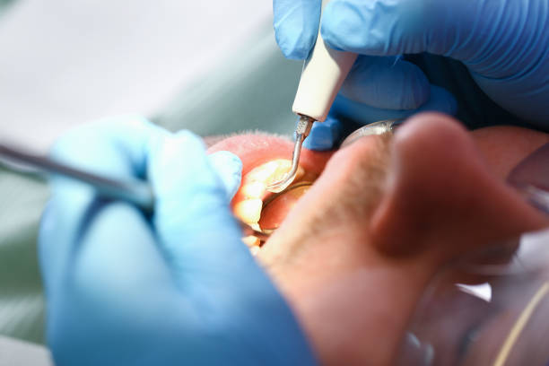 Best Emergency Dentist for Special Needs Patients in Mclendon Chisholm, TX