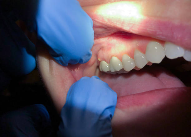  Mclendon Chisholm, TX Emergency Dentist Pros