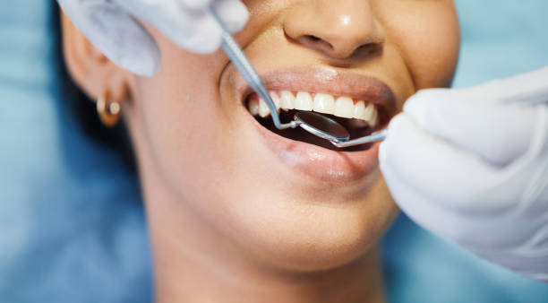 Best Emergency Dental Care for Abscessed Tooth in Mclendon Chisholm, TX